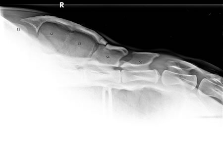 Abbildung 3: Röntgenaufnahme des Sakrums, Strahlengang laterolateral von links nach rechts